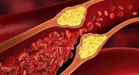 Cara Menurunkan Kadar Kolesterol Dalam Tubuh