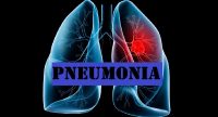 Apa itu Pneumonia ? Penyebab dan Gejalanya