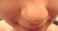 5 Tips Mengencangkan Pori-pori Di Hidung Sangat Efektif